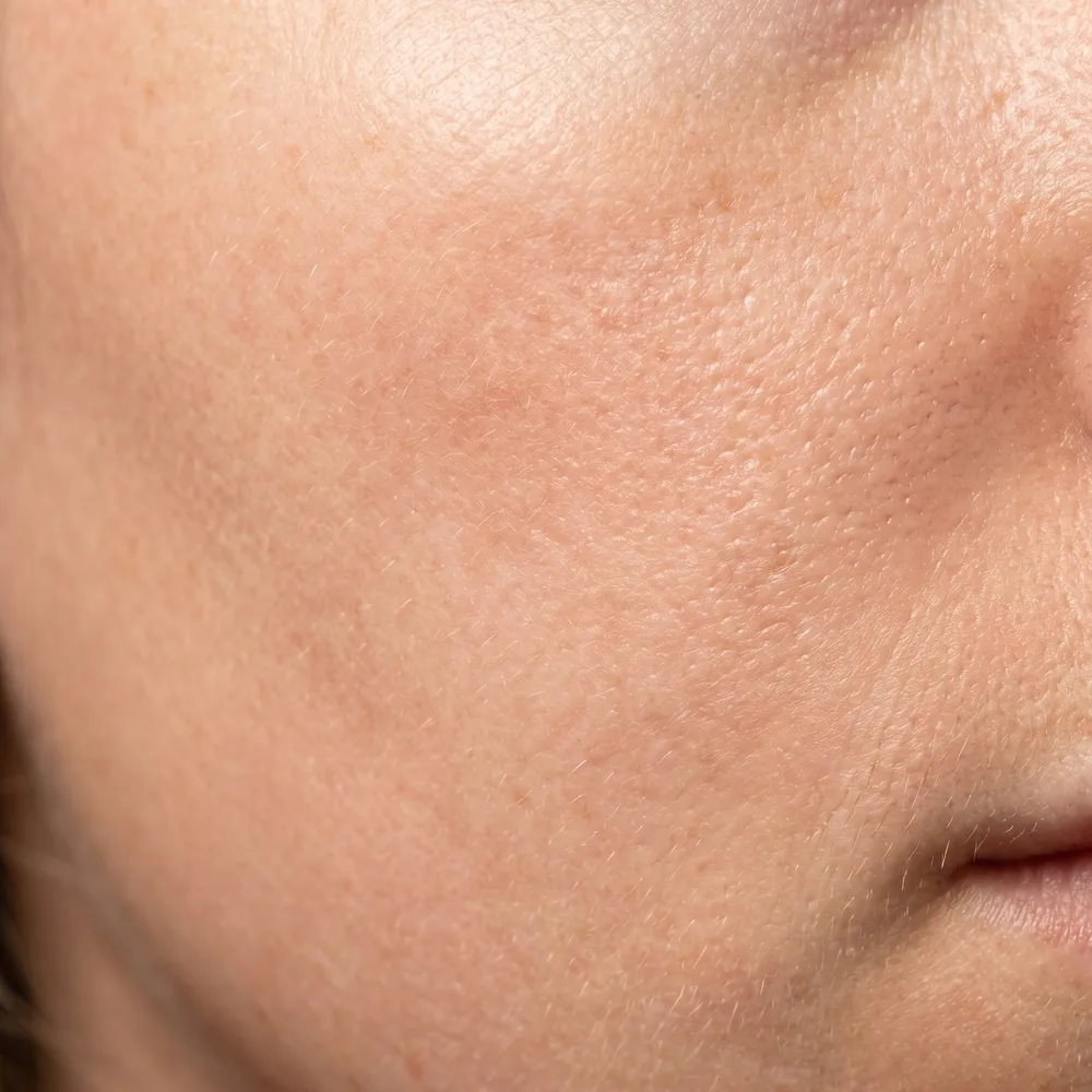 Avatar realista — detalle de piel